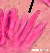 Fig 2 Broom cells of Marasmius Siccus (2)